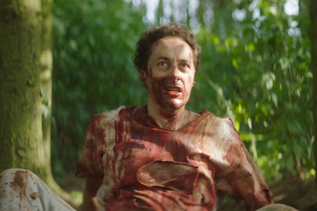 Graham sits in a forest, bloodied and confused, in a scene from THE WILDS